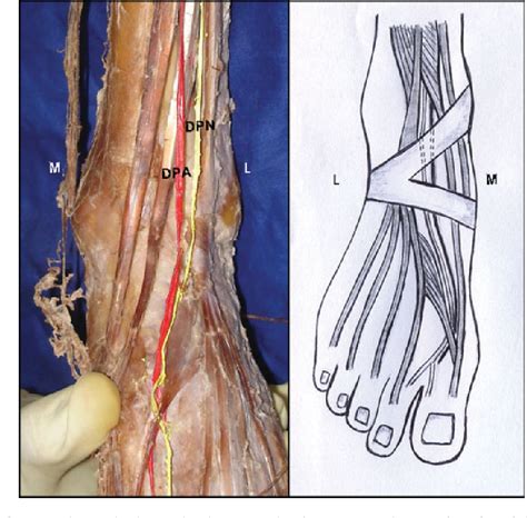 Deep Peroneal Nerve Entrapment Foot Ankle Orthobullet Vrogue Co