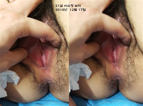 Korean 21 Age Pussy Porn Pic Eporner