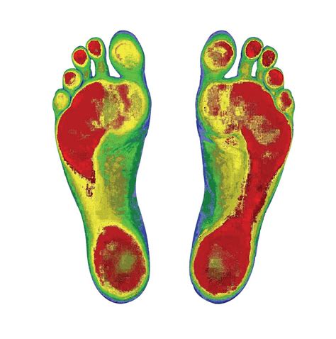 Willaston Physio And Sports Rehab Unveils New 3d Foot Scanner 3d