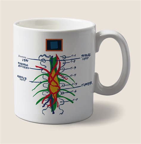 Rhimes initially conceived grey's anatomy as a statement against racism. Caneca Tumor Inoperável Greys Anatomy no Elo7 | Ideal ...