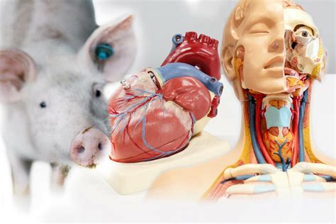 Primer Transplante De Corazón De Cerdo A Un Humano Ciencia