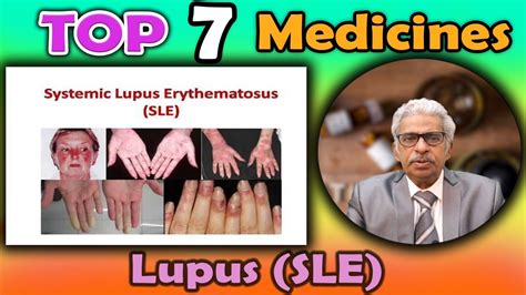 Top 7 Homeopathy Medicines For Lupus Sle Dr Ps Tiwari Youtube