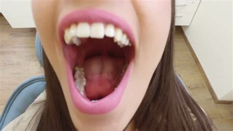 Close Up Of Beautiful Woman With Mouth Wide Open At Dentist Extreme