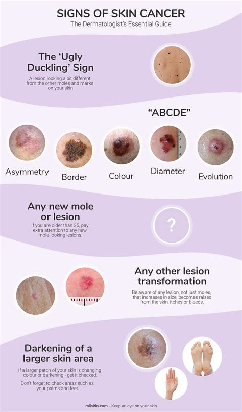 What Are The Warning Signs Of Skin Cancer