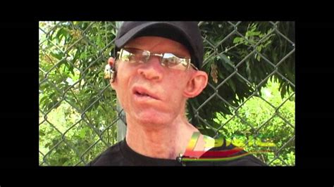 Yellowman The King Of Jamaican Music Part 1 Acordes Chordify