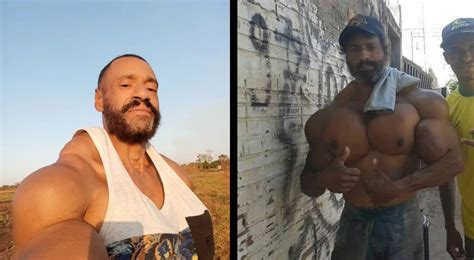 Bodybuilder Known As The Brazilian Hulk Dies After Injecting A Dangerous Substance Ruetir