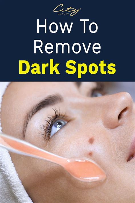 How To Fade Dark Spots Naturally Age Spots On Face Dark Spot Remover