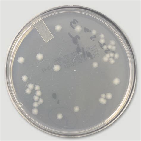 Environmental Isolate Case Files Bacillus Cereus Microbiologics Blog