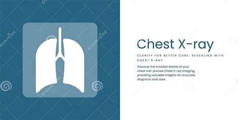 Chest X Ray Banner On Blue And White Background Stylish Banner With