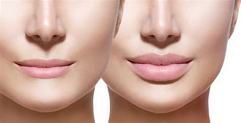 How To Make Your Lips Look Fuller Options For Plump Lips