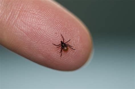 Ask The Expert With Lyme Disease On The Rise Heres How You Can