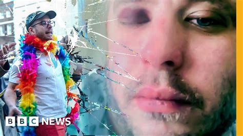 Homophobic Hate Crime Beaten Up For Being Gay Bbc News