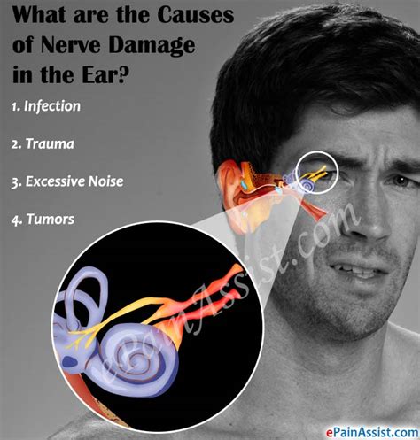 What Are The Causes Of Nerve Damage In The Ear
