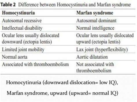 Pin By Inas Salah On Internal Medicine Marfan Syndrome Ocular