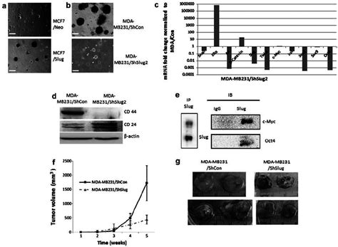 Slug Promotes Tumor Formation And Metastasis A MCF7 Cells After