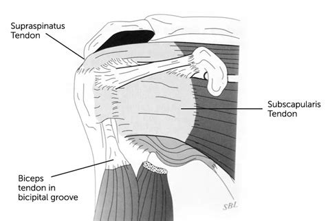 Subscapularis Tears Dr David Duckworth