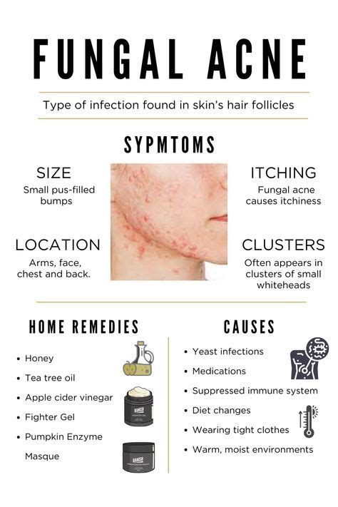 How To Tell If You Have Fungal Acne Skin Care Acne Facial Skin Care