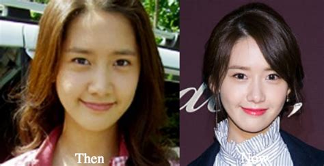 Yoona Plastic Surgery Before And After Photos Latest Plastic Surgery Gossip And News Plastic