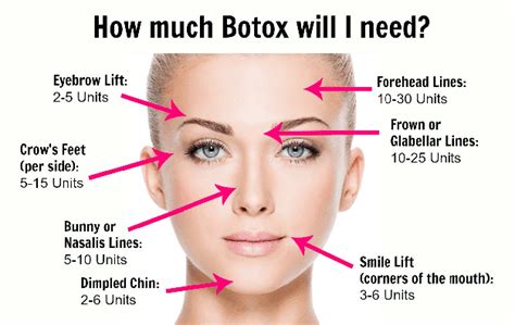 How Many Units Of Botox Things I Wish I Knew Before I Got Botox