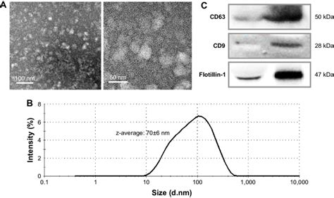 Characterization Of The Isolated Exosomes By Transmission Electron