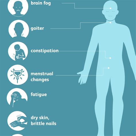 Hashimotos Disease Signs Symptoms And Complications