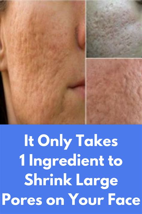 It Only Takes 1 Ingredient To Shrink Large Pores On Your Face Enlarged