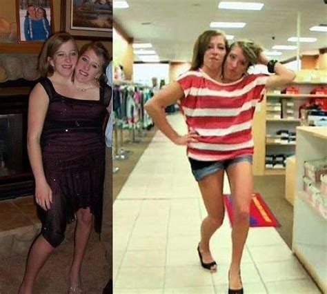 abby and brittany hensel conjoined twins where are they now oddlasopa