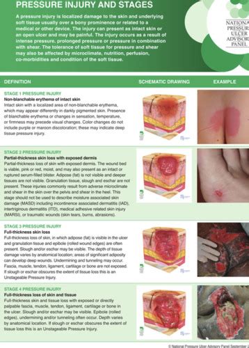 Pressure Injury Staging Flashcards Quizlet