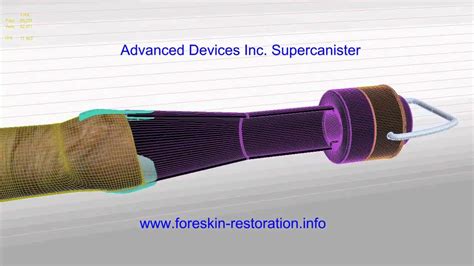 Foreskin Restoration Reverse Circumcision Damage For Better Sex Supercanister By Advanced