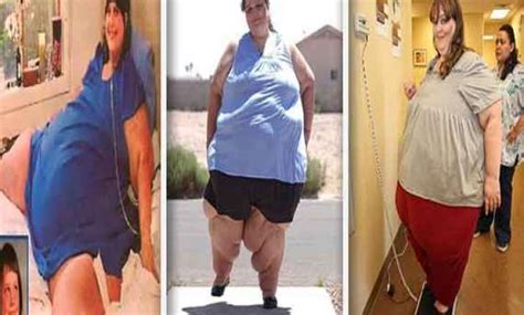 Know More About Worlds Fattest Woman Carol Yager World News India Tv