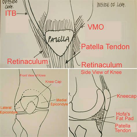 Check spelling or type a new query. Front of the Knee Pain: Part 1