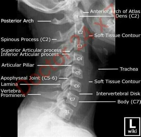 7 Best X Ray Apom Images On Pinterest X Rays Anatomy And Anatomy