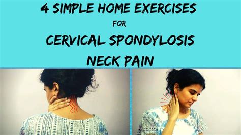 Best Cervical Spondylosis Exercise Neck Pain Relief Exercise Cervical Spondylosis Treatment