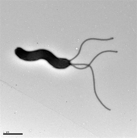 Figure 12 From Studies On Helicobacter Pylori Motility Influence Of