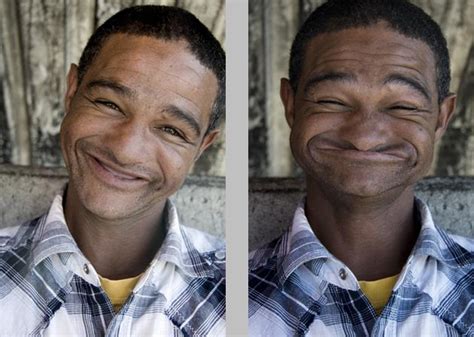 Man With No Teeth Smiling Teethwalls