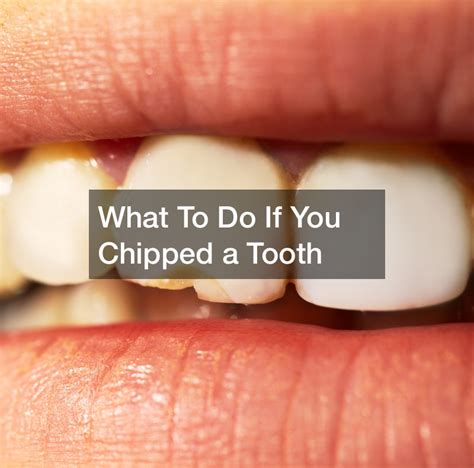 what to do if you chipped a tooth dentist dentists nexusweb