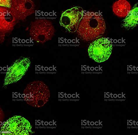 Real Fluorescence Microscopic View Of Human Dendritic Cells Stock Photo