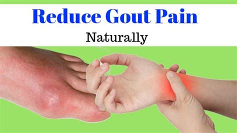 Gout Home Remedies Sore Toes Home Remedies For Gout Gout Remedies