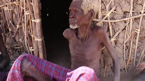 Kenyan Anger Over Turkana Starvation Being Ignored Bbc News