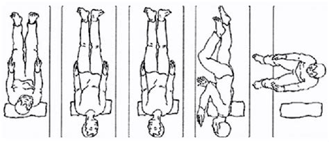 Epley Epley Maneuver Physiotherapy Exercise Technique Of
