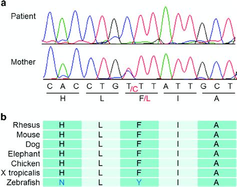 Sanger Sequencing Results A Hemizygous And Heterozygous Mutations Of Download Scientific