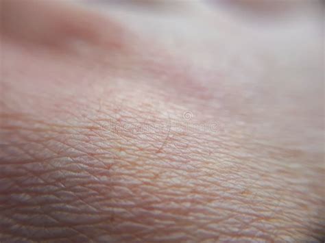 Macro Human Skin On Hand Details Of Healthy Orange Skin Stock Image