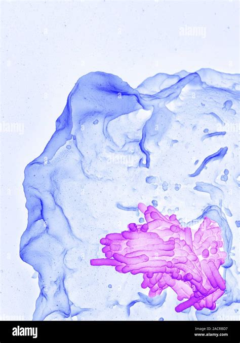 Macrophage Engulfing Tb Bacteria Coloured Scanning Electron Micrograph