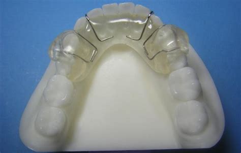 Twin Block Accutech Orthodontic Laboratory Products