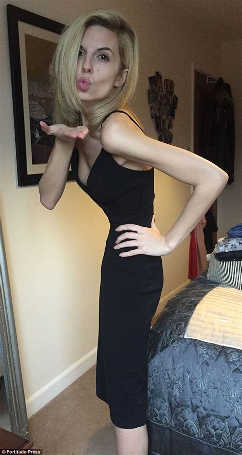 Anorexic Essex Woman Who Was A Size Zero Is Saved By Instagram Daily