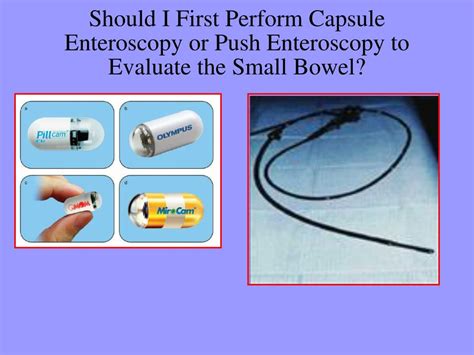 Ppt Endoscopic Imaging Of The Small Bowel Powerpoint Presentation