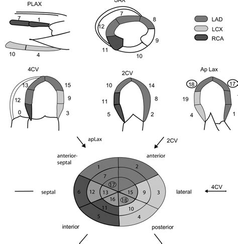 17 Segment Cardiac Model Download Scientific Diagram