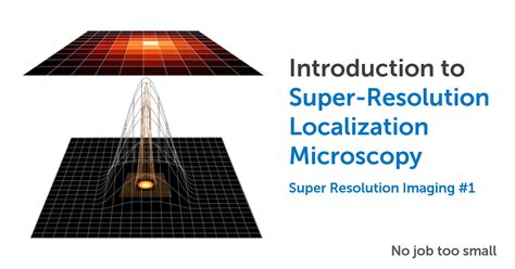 Super Resolution Localization Microscopy