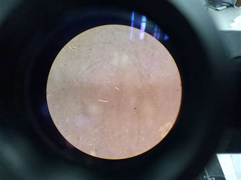 Experiment 6: Preparation of bacterial smear, Experiment 7 ...