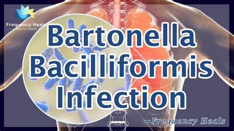 Bartonella Bacilliformis Infection Healing Energy And Quantum Medicine